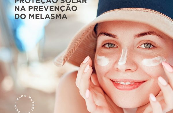 Melasma – Como o uso do filtro solar pode te ajudar na Prevenção